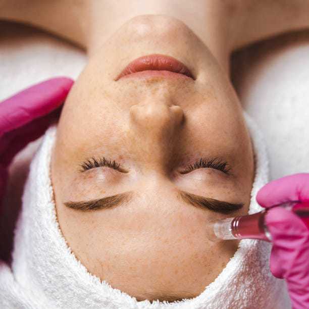 Facial treatment with microdermabrasion pen on woman's forehead, wearing pink gloves.