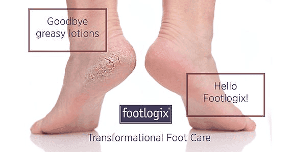 Two feet showing before and after using Footlogix for smooth skin; text highlights the product.